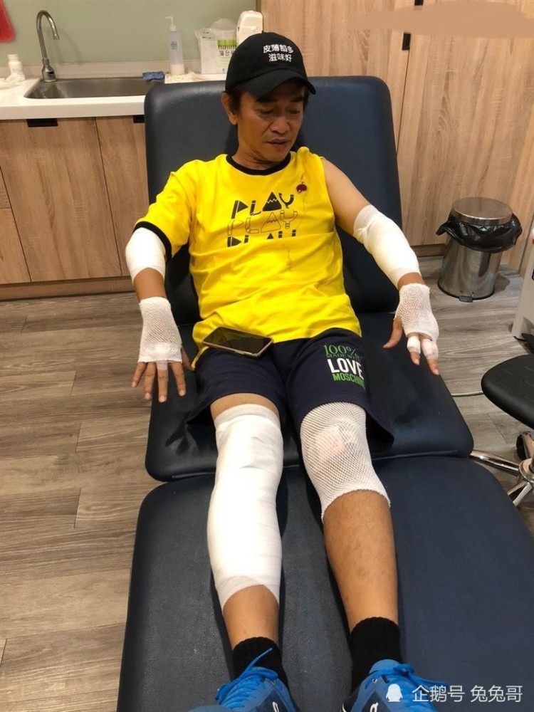 吴宗宪|吴宗宪录节目意外受伤，处理伤口照流出，之后还要检查脑部