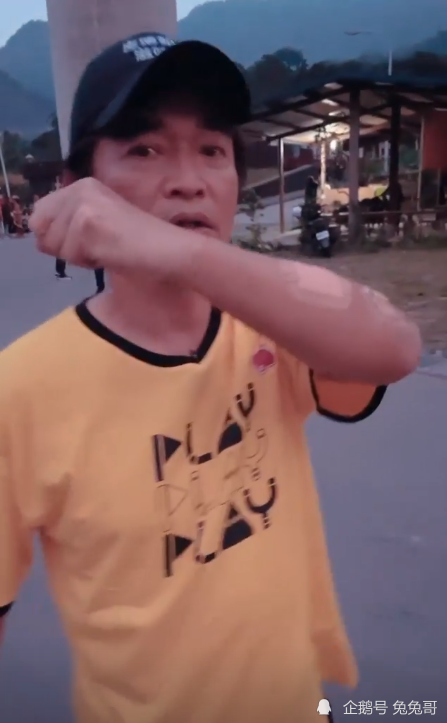 吴宗宪|吴宗宪录节目意外受伤，处理伤口照流出，之后还要检查脑部