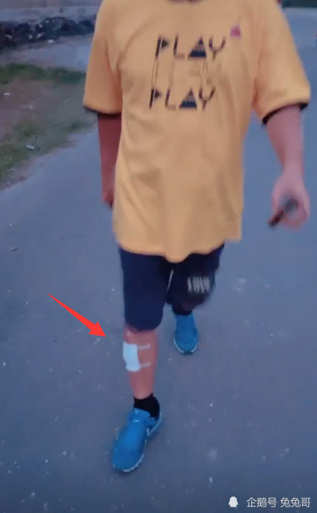 吴宗宪|吴宗宪录节目意外受伤，处理伤口照流出，之后还要检查脑部