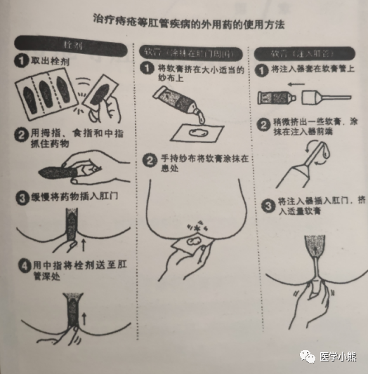 得了痔疮用什么药效果好