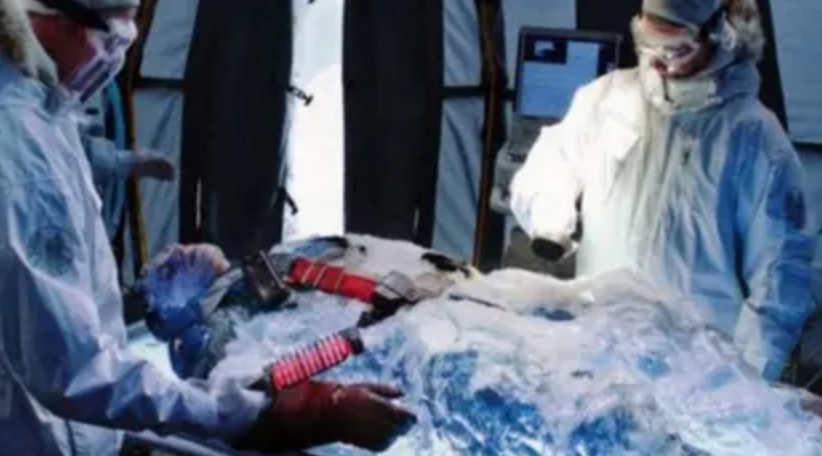 杜虹|我国首位冷冻人杜虹，只有头部保存完好，计划在2065年复活