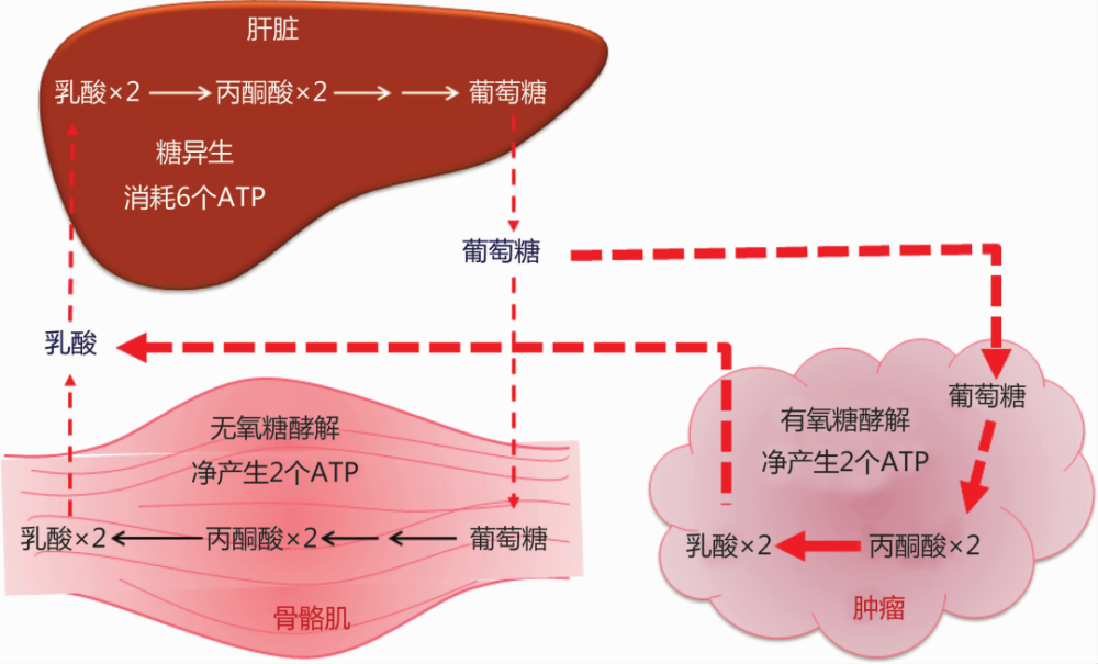 請注意惡性腫瘤營養不良的7大特徵一份理想的腫瘤患者營養治療配方