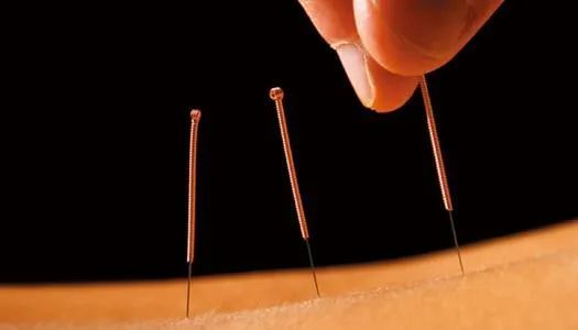 针灸扶阳——立极针法