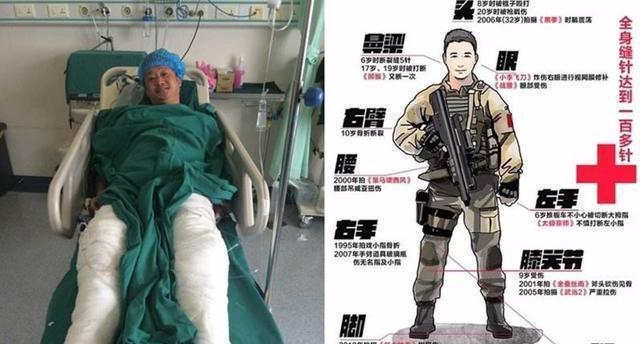 吴京|吴京自曝身体状况令人揪心：谢楠每天都帮自己按摩，疼到睡不着觉