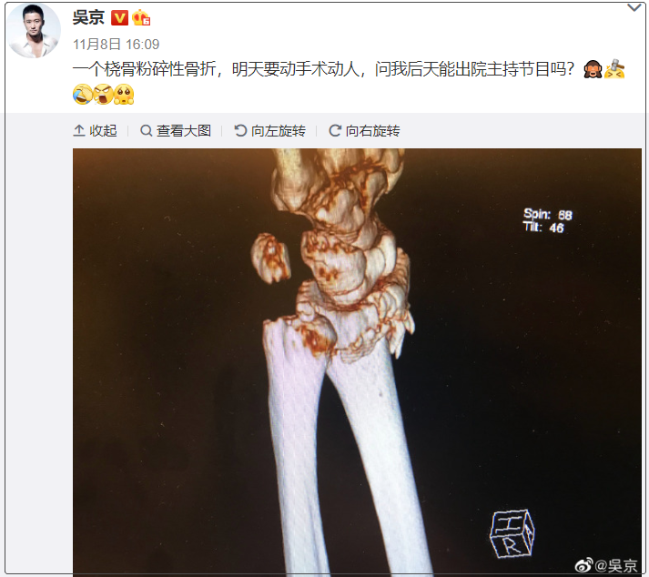 谢楠|两人强势暴躁的人居然能处得这么和谐！谢楠真该出本御夫秘笈