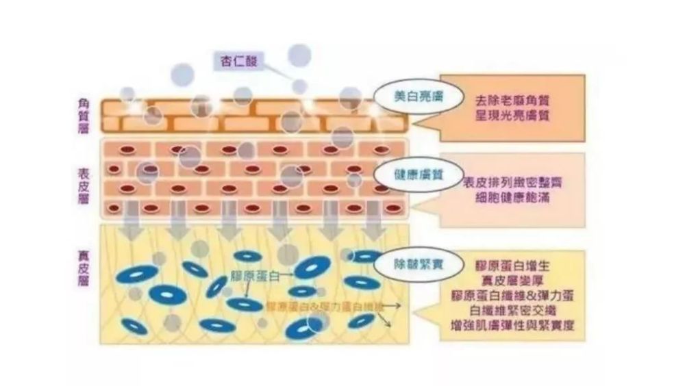 常说的刷酸是指哪些酸如何正确刷酸