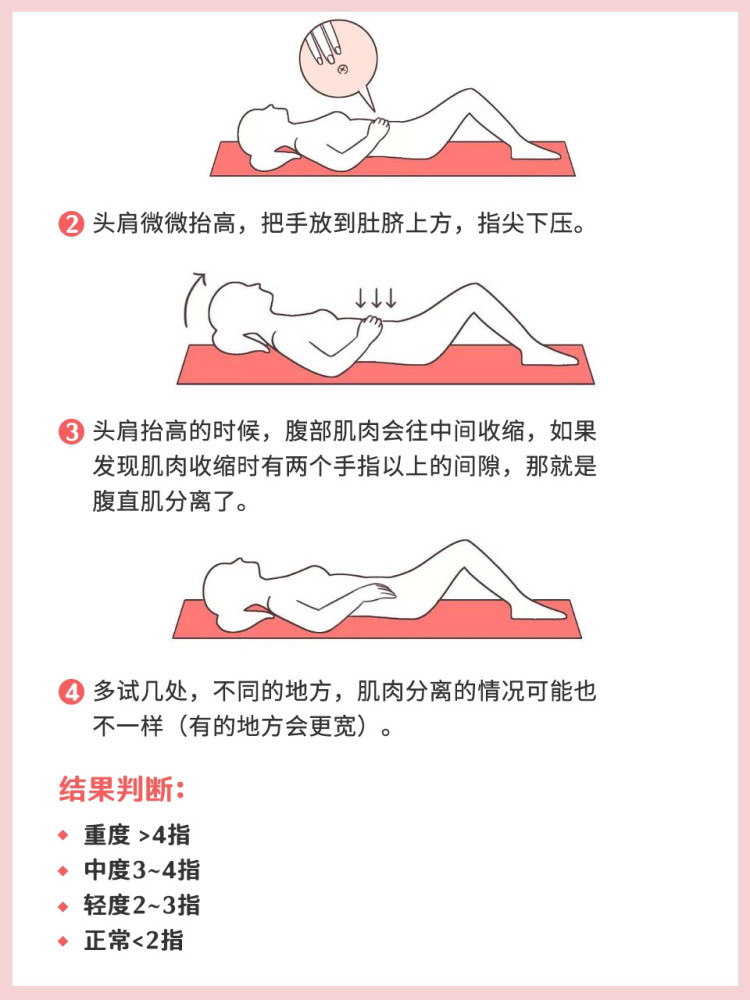 产后修复攻略最有效的腹直肌修复图解操