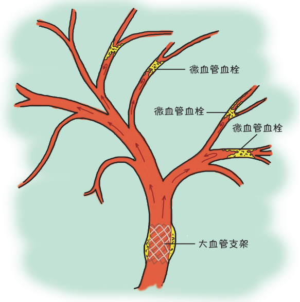 人体的血管是一个大系统