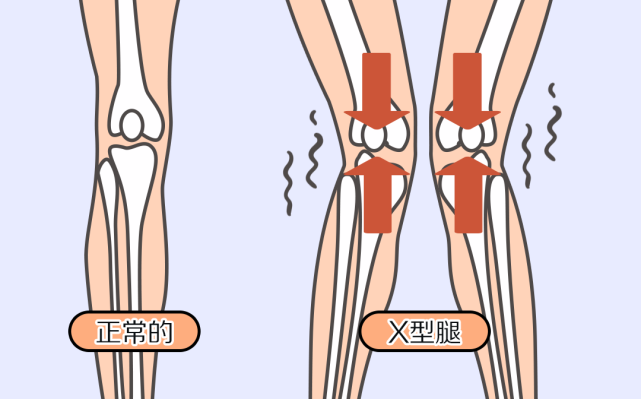 膝蓋疼是怎麼回事?這些原因不容忽視