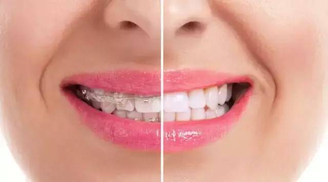 一入"牙门"深似海,我真是太难了……_腾讯新闻