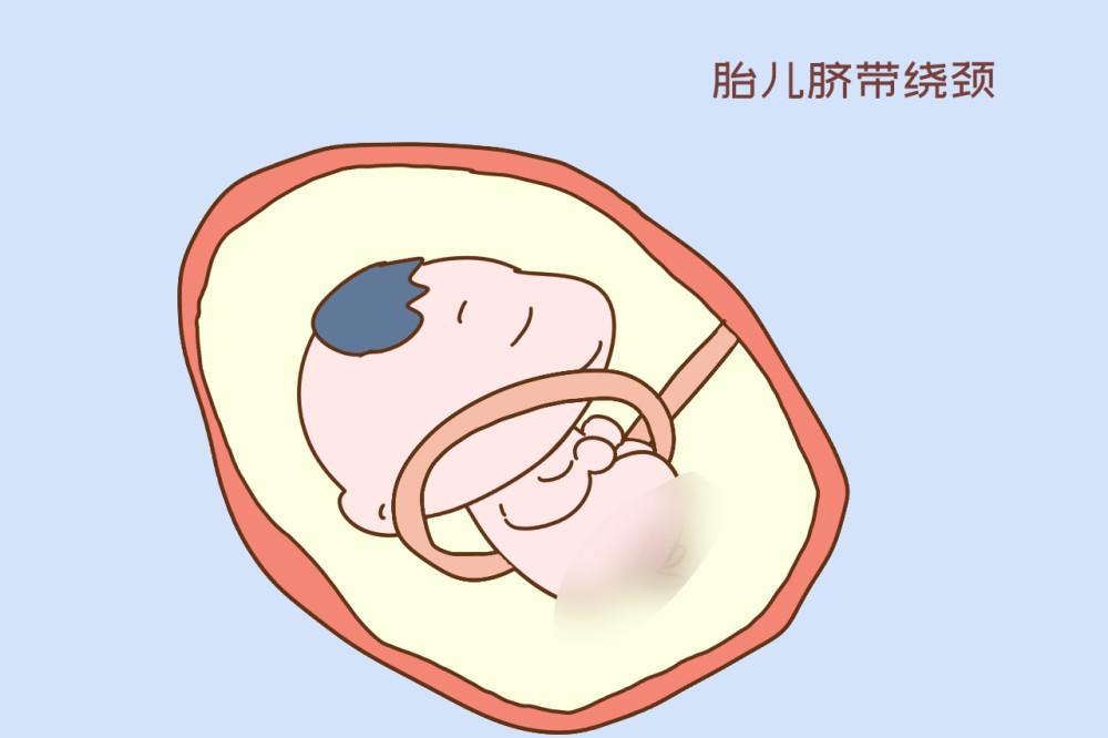 医生说宝宝胎心有点快是在提示什么?其中门道很深,孕妈要知道