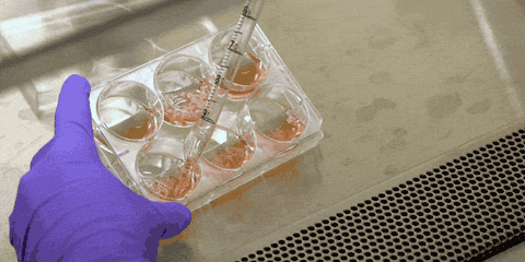 用嘴吮吸来转移病菌液,这在以前的实验室是常规操作