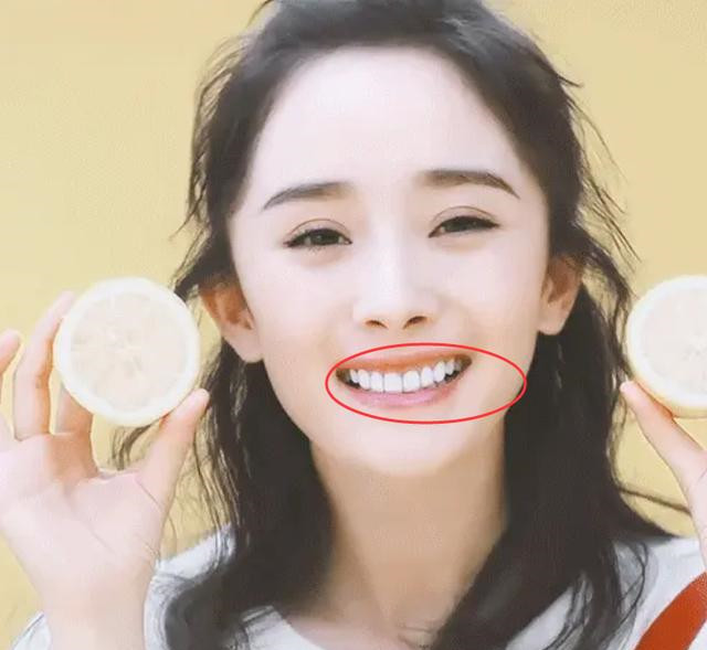 但矫正之后,杨幂的牙齿却不及原来好看.