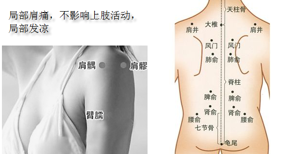 肩周炎的针灸治疗 腾讯新闻