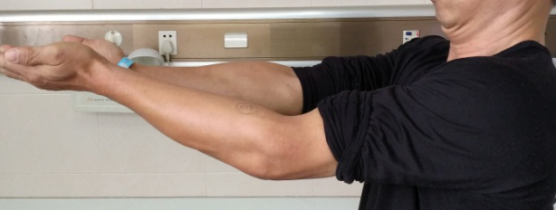 男子左手肘伸不直,竟是因为肘关节内藏了"小石子"_腾讯新闻