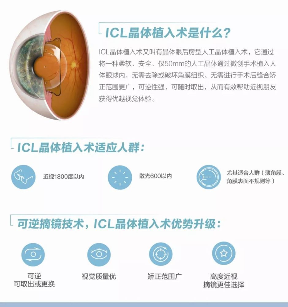 一文读懂系列之近视手术的种类 腾讯新闻