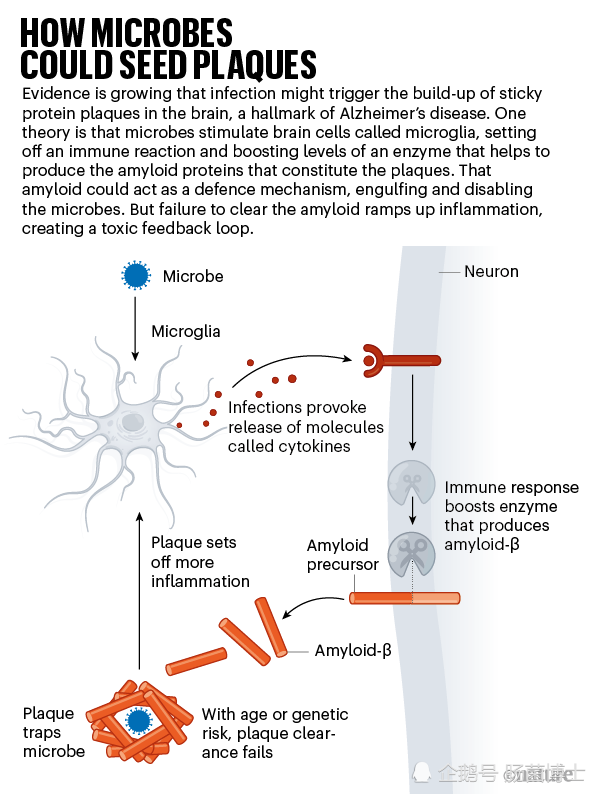搞错了 微生物感染可能才是阿尔兹海默症的元凶 阿尔兹海默症 微生物 单纯疱疹病毒 Ad