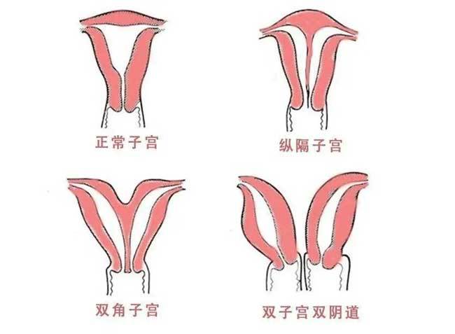 試管嬰兒中胚胎停育的原因一般出現在哪幾個細節