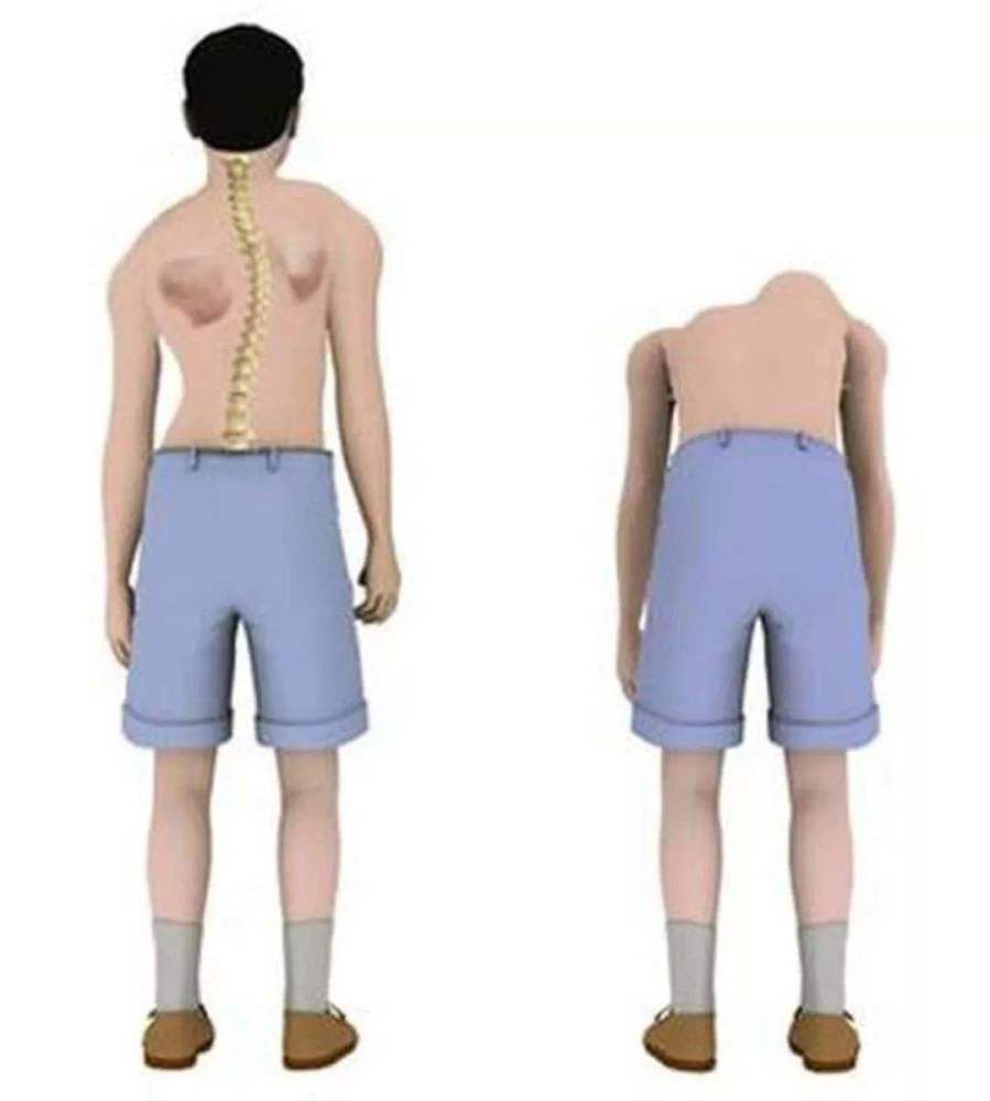 长个快当心高低肩_腾讯新闻