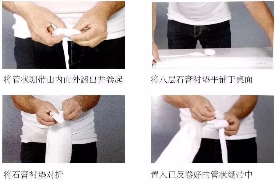 绷带固定法轻松应对各部位骨折