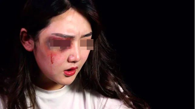 我被家暴了依然很美可别恶心人了