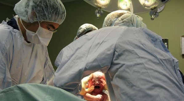 顺产时孩子被一把拽出来有什么感觉过来人宁可剖腹产