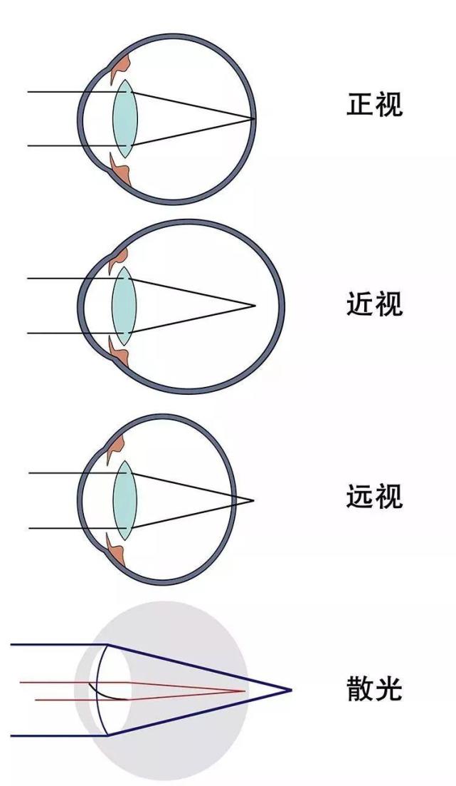我们一起了解-眼球结构|角膜|眼球|屈光|视网膜