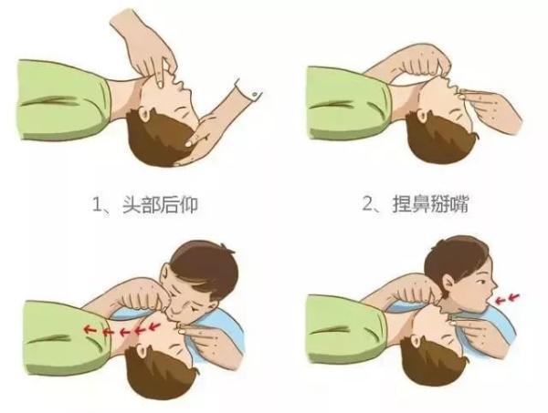 控制体重,多运动.3.若出现心悸,胸闷胸痛,呼吸困难,浮肿,及时就医.4.