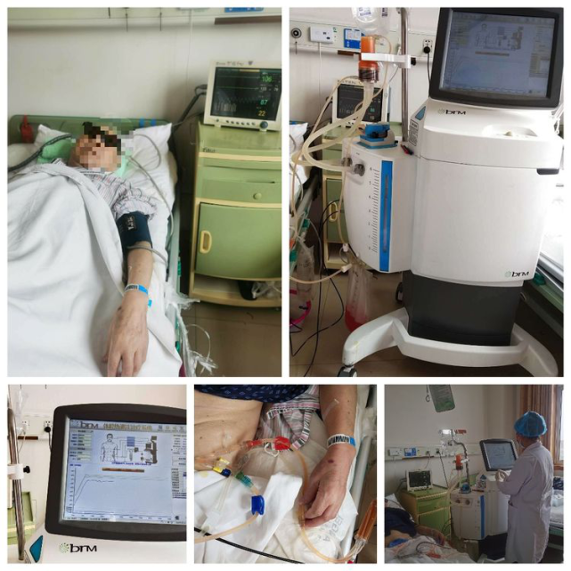 患者正在用热灌注机做膀胱热灌注化疗