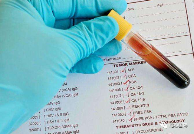 cea,afp,psa(男性),ca199,ca153等腫瘤標誌物檢測,已成為常見的體檢