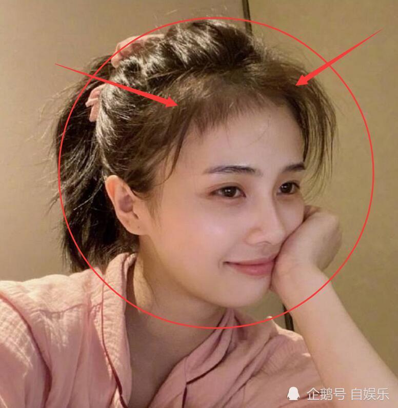 白鹿也逐漸鞠婧禕化胎毛佔半個腦門網友評論卻截然不同