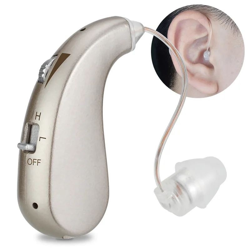 关于人工耳蜗～你所不知道的那些事儿