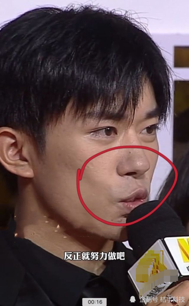 金鸡奖红毯:易烊千玺皮肤"垮掉",离开滤镜痘痘太多