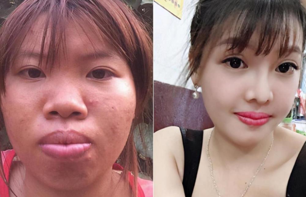 女子因长相丑陋被前夫抛弃,整容变漂亮后即将和初恋男友结婚