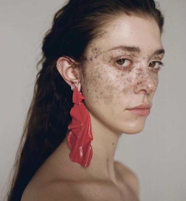 长雀斑的人命运怎么样『长雀斑的人命运怎么样呢』