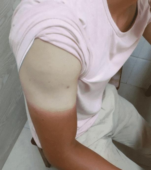 据说工地上的人,身上的肤色就是这样的,黑的让你怀疑人生,白的让你