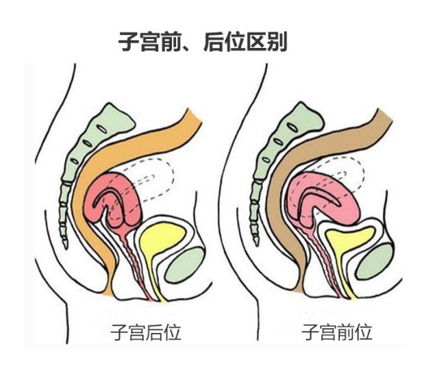 贝安 子宫后位对怀孕有影响吗 子宫后位 子宫 怀孕 贝安 子宫颈