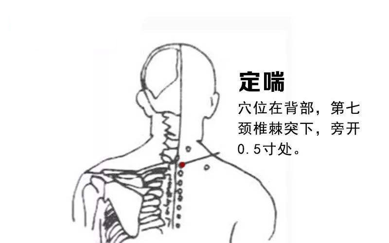 久治不愈的咳嗽必灸穴位及配穴