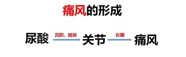 什么是痛风 为何多发在第一跖趾关节 高尿酸血症 第一跖趾关节 痛风 尿酸