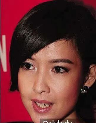 人均一副烤瓷牙的娱乐圈大概早已忘记了美人三分龅