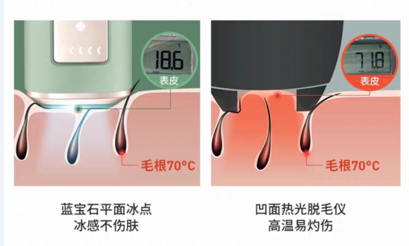 最畅销脱毛仪ulike 飞利浦 慕金 Jovs等品牌大测评谁更值得买 腾讯新闻