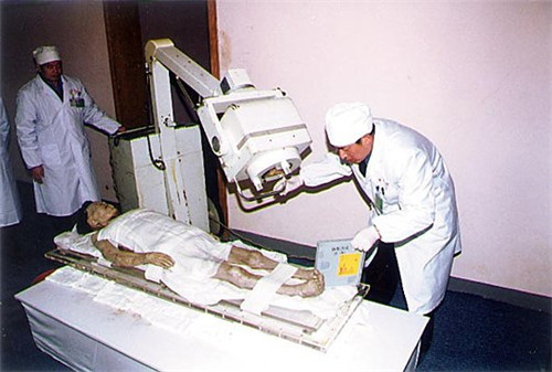 当关于辛追夫人遗体的研究记录传出来后,震惊了整个世界的考古界以及