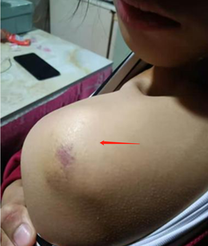 遵义9年级学生被体罚,身上多处淤青,学生父亲发长文怒斥_腾讯新闻