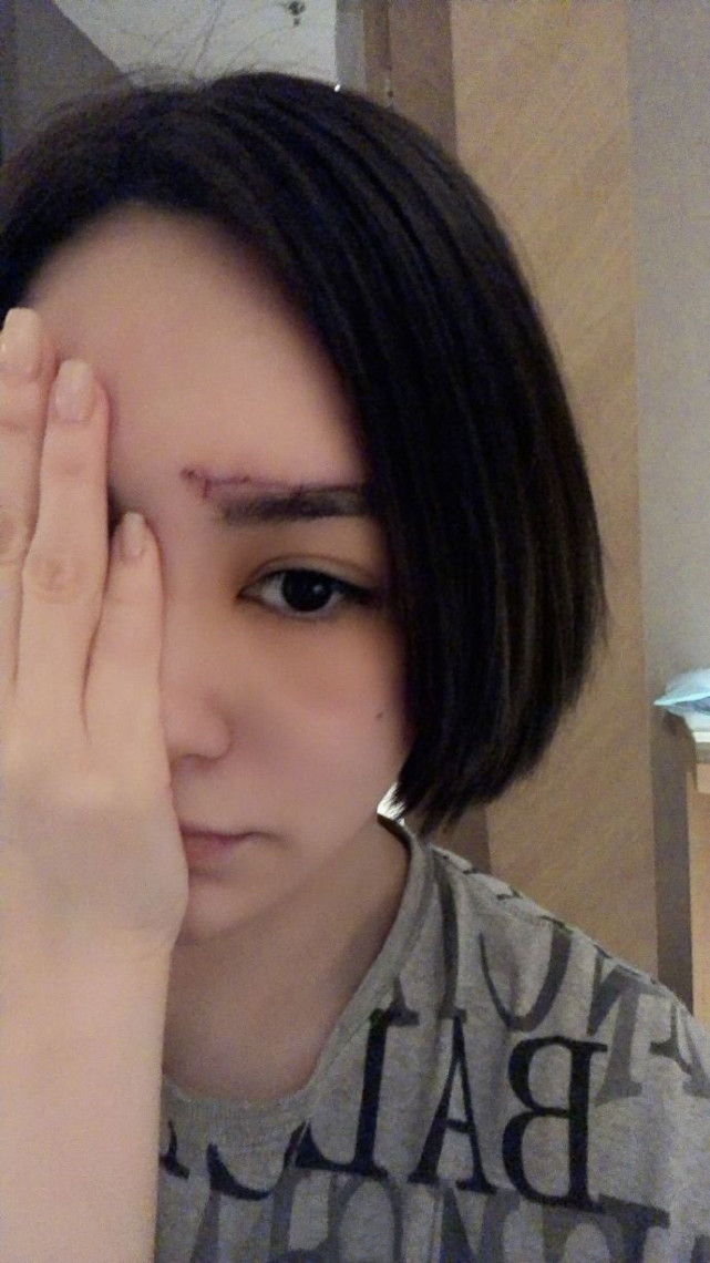 阿娇喜迎家庭新成员,晒近照尖下巴超抢镜