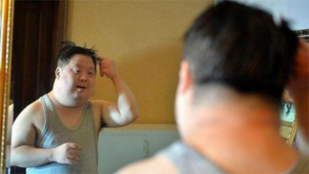 天生智障舟舟被誉为"天才指挥家",从出生以来,他就患有先天性愚型症