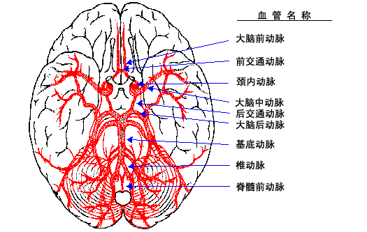 教你如何轻松看懂脑血管造影