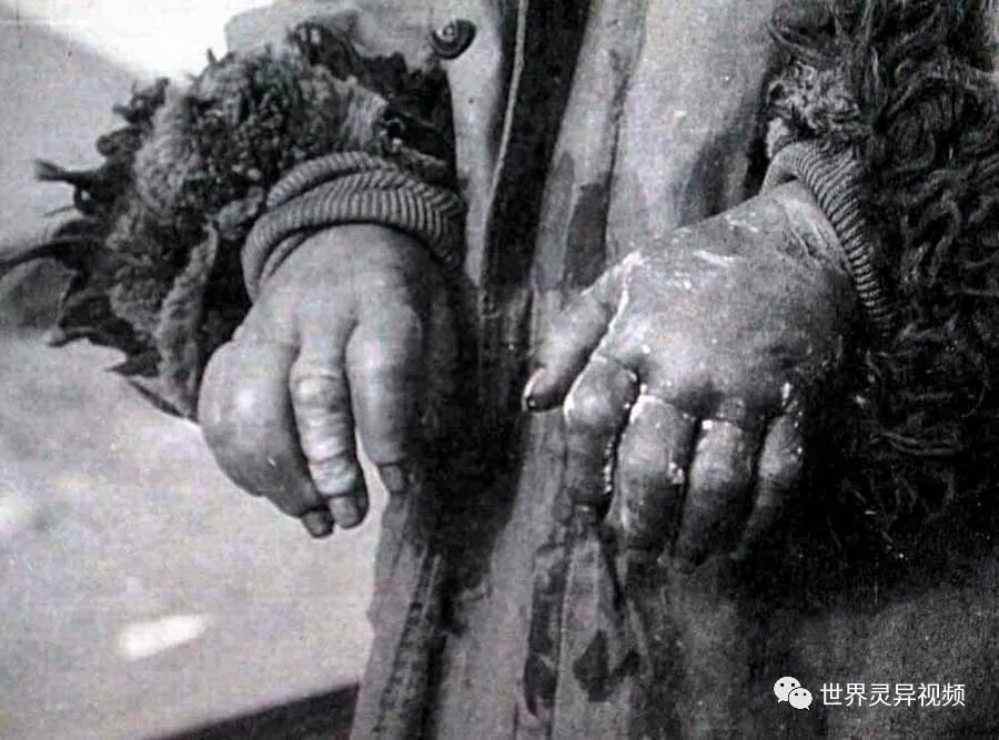 731部队女体实验内容没有日本人不敢干的事情