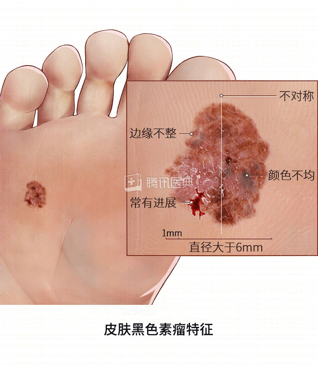 洗澡多看一眼就能發現!