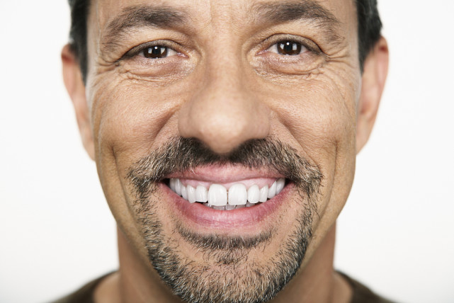 男人面相不同形状的鱼尾纹运势都有哪些不同 腾讯网