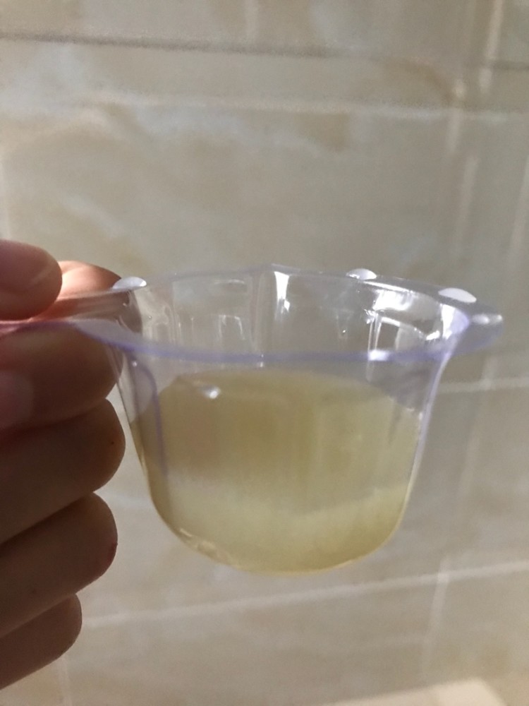 冬天起床后身体出现3个表现,说明血糖已经高了,糖尿病人要警惕_腾讯